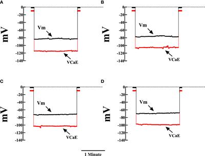 The Role of the Na+/Ca2+ Exchanger in Aberrant Intracellular Ca2+ in Cardiomyocytes of Chagas-Infected Rodents